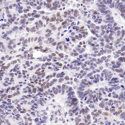 CDK6 Recombinant Rabbit mAb (S-1312-23)