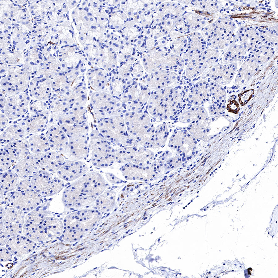 Smooth Muscle Myosin Heavy Chain (SMMHC) Recombinant Rabbit mAb (SDT-R089)