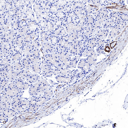 Smooth Muscle Myosin Heavy Chain (SMMHC) Recombinant Rabbit mAb (SDT-R089)