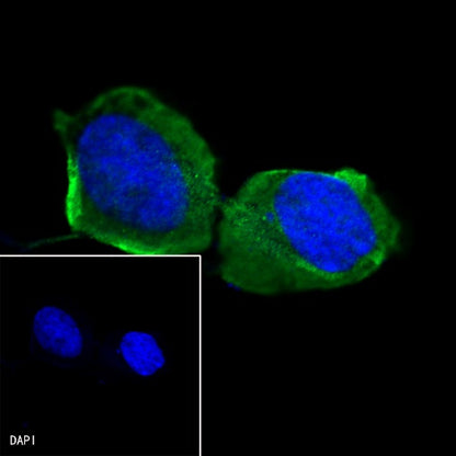 Lumican Recombinant Rabbit mAb (S-247-47)