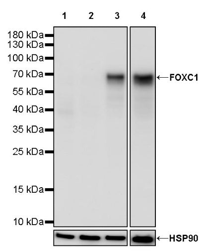 FOXC1 Recombinant Rabbit mAb (S-1607-142)