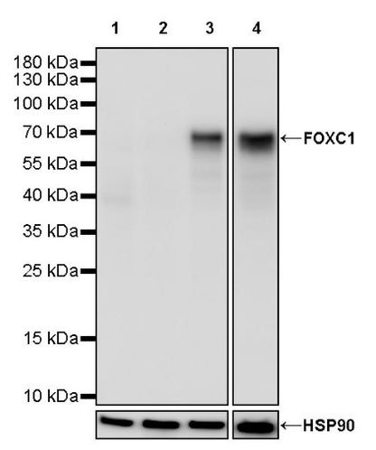 FOXC1 Recombinant Rabbit mAb (S-1607-142)