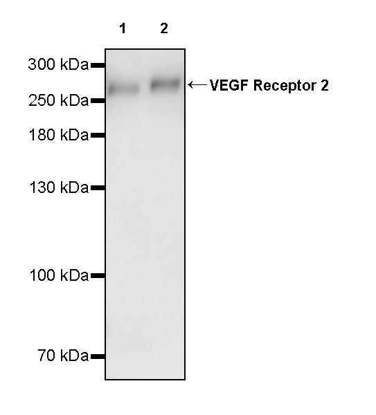 VEGF Receptor 2 Recombinant Rabbit mAb (S-3912-20)