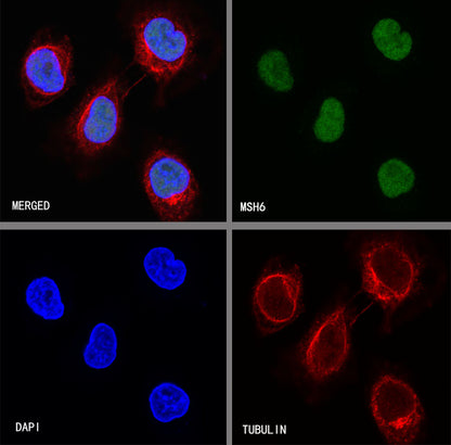 S-RMab® MSH6 Recombinant Rabbit mAb,PBS Only (SDT-R094)