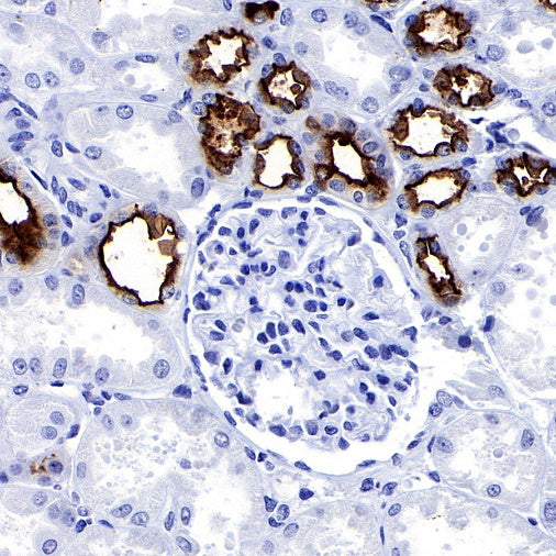 MUC1/EMA Mouse mAb (SDT-777-37)
