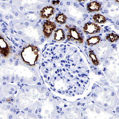 MUC1/EMA Mouse mAb (SDT-777-37)