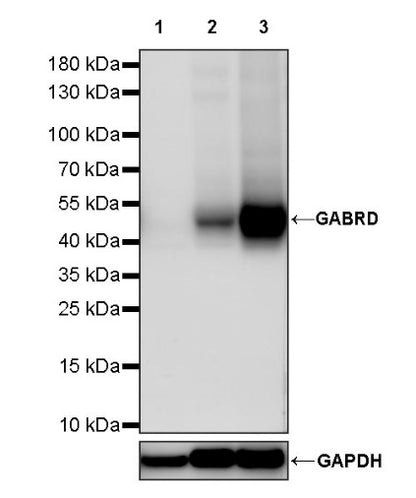 GABRD Recombinant Rabbit mAb (S-1584-162)