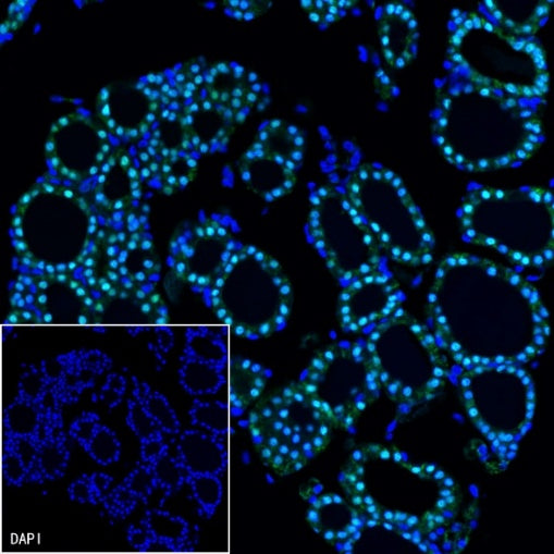 PAX8 Recombinant Rabbit mAb (SDT-R509)