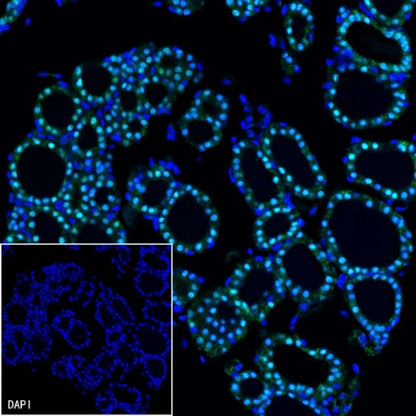 PAX8 Recombinant Rabbit mAb (SDT-R509)