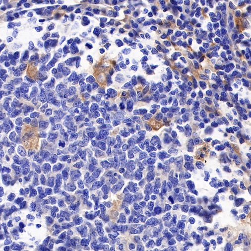 GBP1 Recombinant Rat mAb (S-R186)