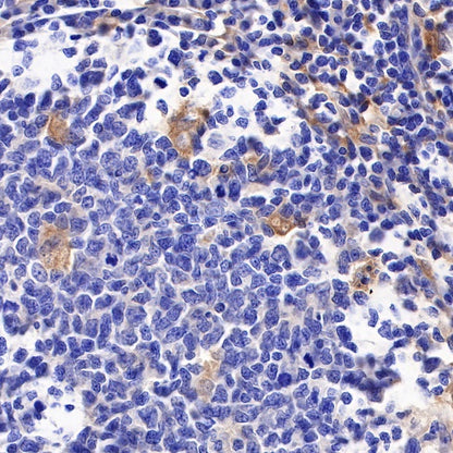 GBP1 Recombinant Rat mAb (S-R186)