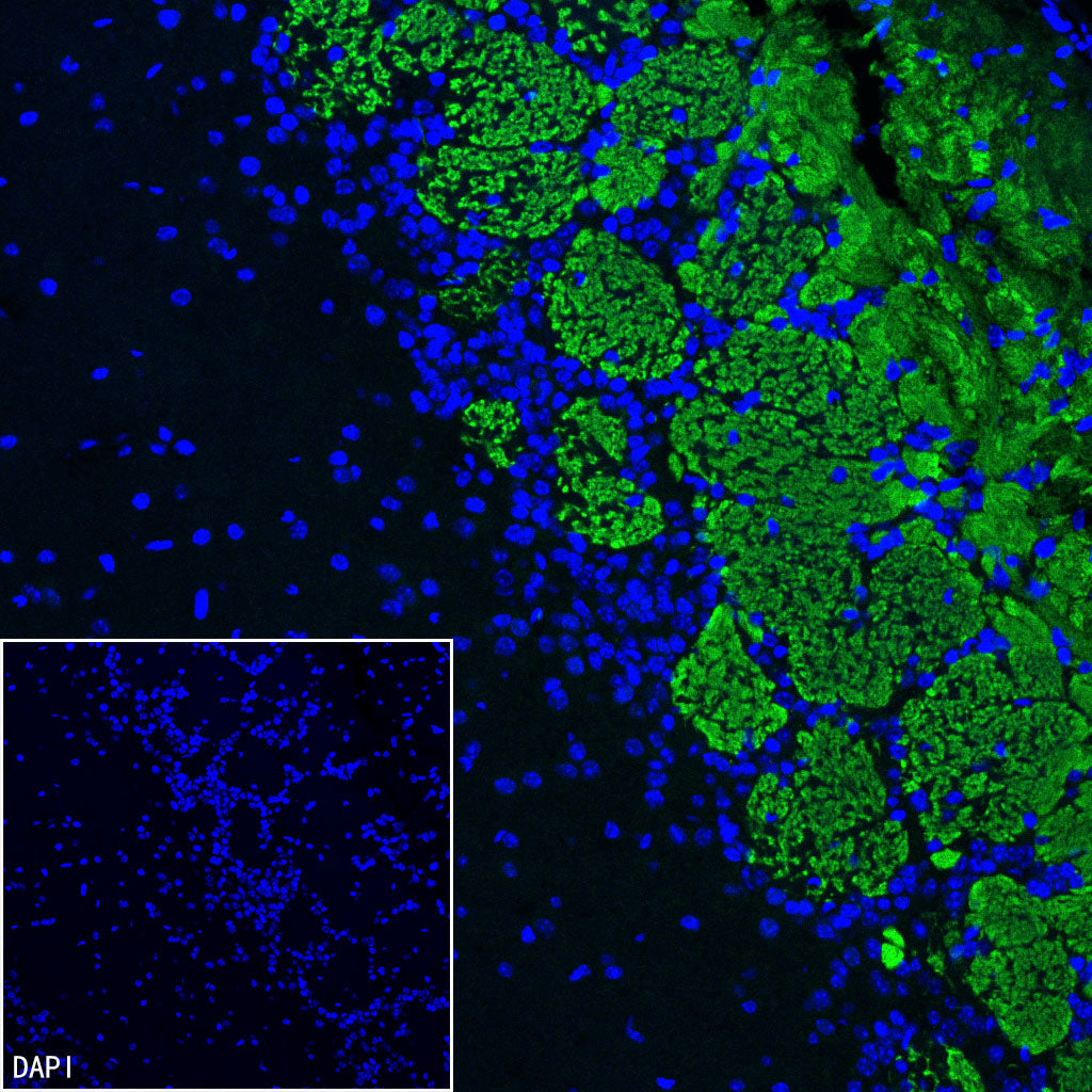 Olfactory Marker/OMP Recombinant Rabbit mAb (S-3513-32)