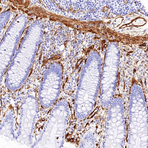 EHD2 Recombinant Rabbit mAb (S-1580-60)