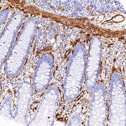 EHD2 Recombinant Rabbit mAb (S-1580-60)