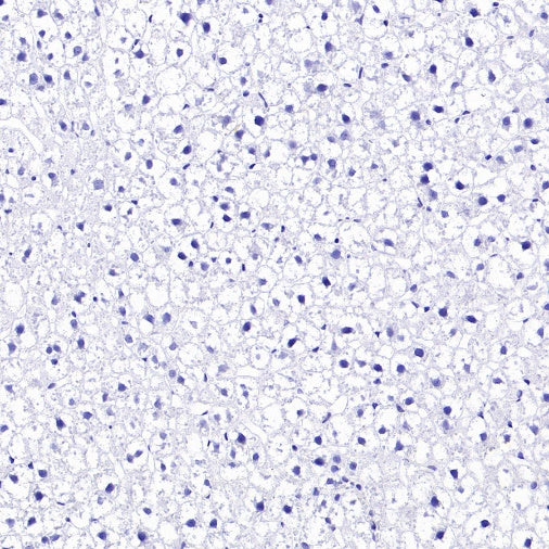 KCND2 Recombinant Rabbit mAb (S-3102-32)