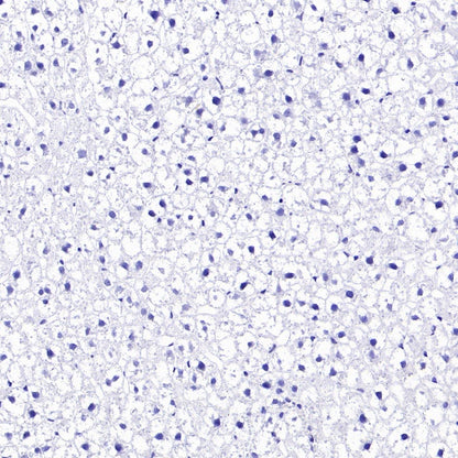 KCND2 Recombinant Rabbit mAb (S-3102-32)