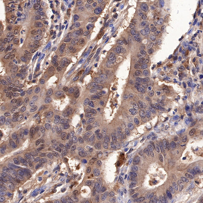 Galectin-3 Recombinant Rabbit mAb (SDT-370-111)