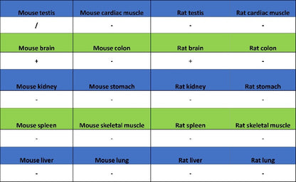 Choline Acetyltransferase/ChAT Recombinant Rabbit mAb (S-2561-17)