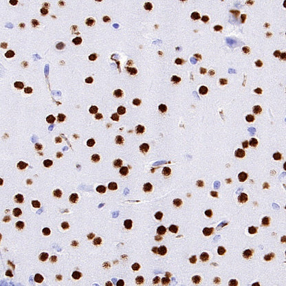 Ctip2 Recombinant Rabbit mAb (S-1375-21)