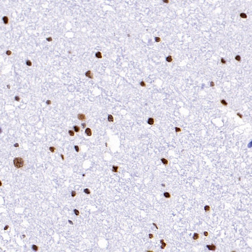 Phospho-Histone H2A.X (Ser139) Recombinant Rabbit mAb (S-1368-15)