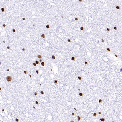 Phospho-Histone H2A.X (Ser139) Recombinant Rabbit mAb (S-1368-15)