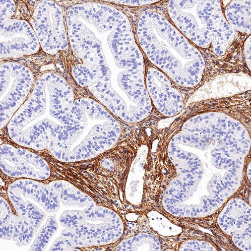 Collagen VI (COL6A1) Recombinant Rabbit mAb (S-1495-18)