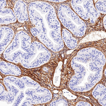 Collagen VI (COL6A1) Recombinant Rabbit mAb (S-1495-18)