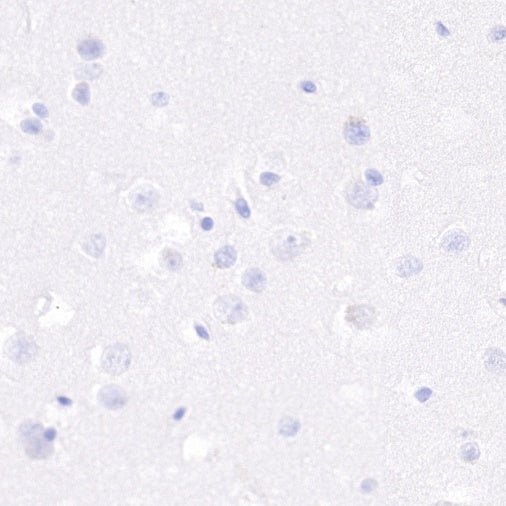 S-RMab® Ki67 Recombinant Rabbit mAb (SDT-10002)