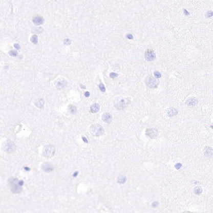 S-RMab® Ki67 Recombinant Rabbit mAb (SDT-10002)