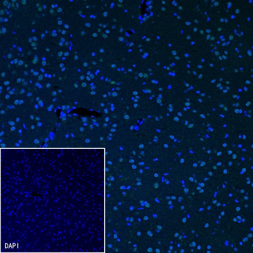 DARPP32 Recombinant Rabbit mAb (S-1637-62)