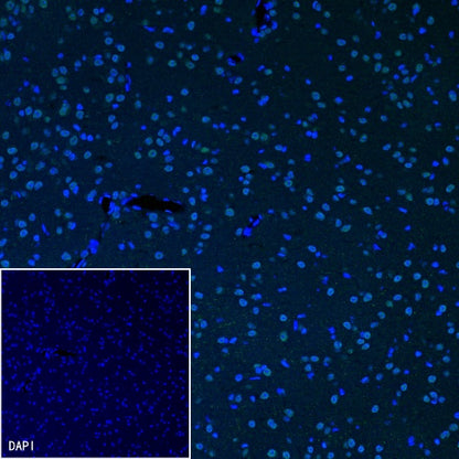 DARPP32 Recombinant Rabbit mAb (S-1637-62)