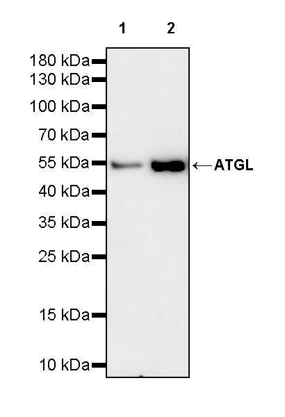 ATGL Recombinant Rabbit mAb
