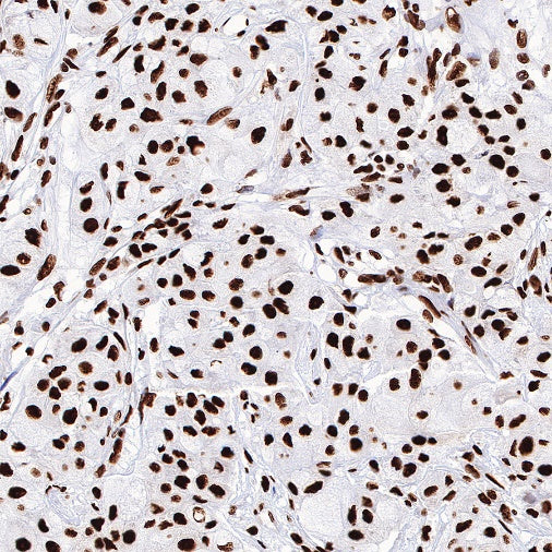 ILF3 Recombinant Rabbit mAb (S-R342)