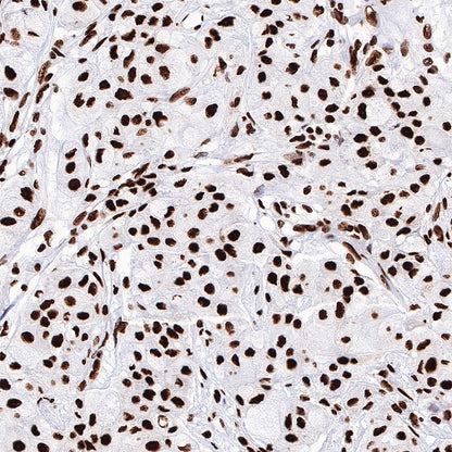 ILF3 Recombinant Rabbit mAb (S-R342)