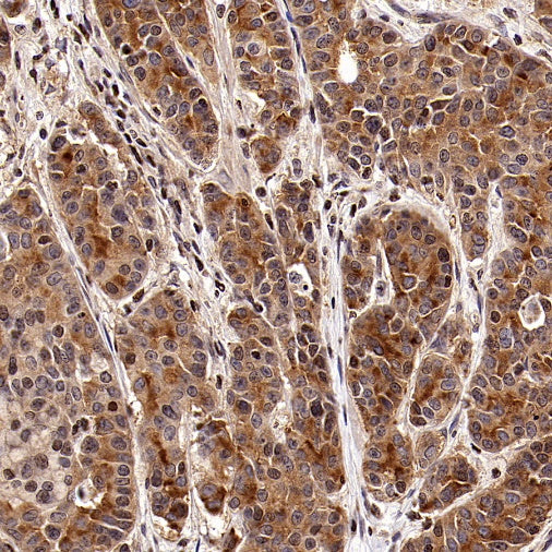 SCAMP1 Rabbit Polyclonal Antibody