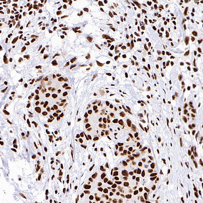 SP1 Recombinant Rabbit mAb (S-4102)