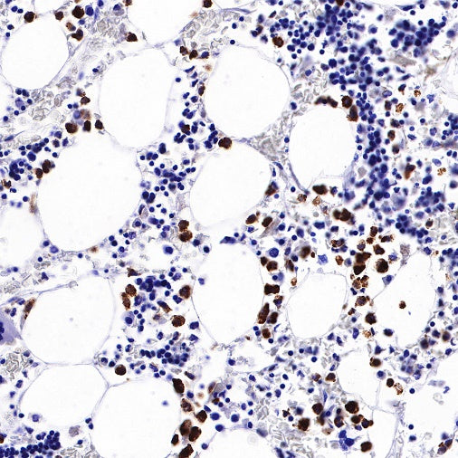 Neutrophil Elastase Recombinant Rabbit mAb (S-R230)