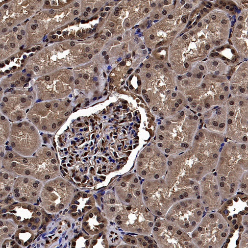 Erk1/2 Recombinant Rabbit mAb (S-3178)