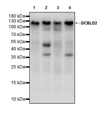 DCBLD2 Recombinant Rabbit mAb (S-3292-46)