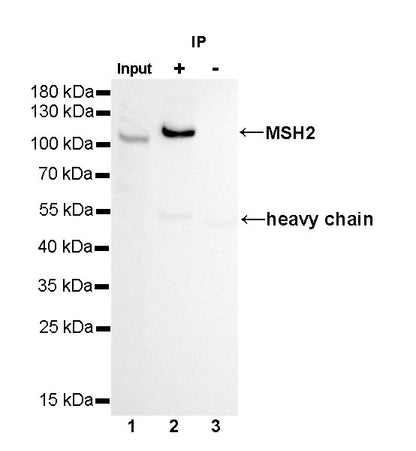 MSH2 Recombinant Rabbit mAb (SDT-037-20)