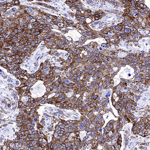 CK7/8 Recombinant Rabbit mAb (SDT-P006)
