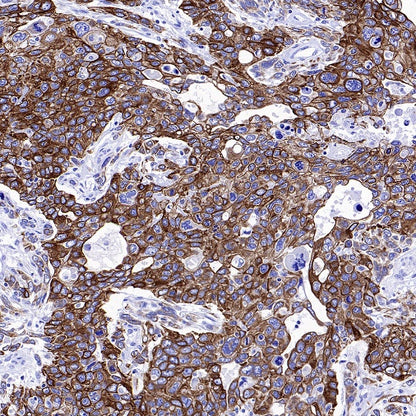 CK7/8 Recombinant Rabbit mAb (SDT-P006)
