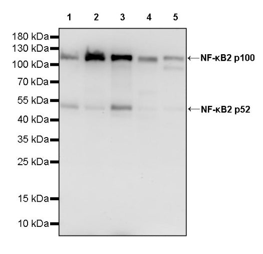 NF-κB2 p100/p52 Recombinant Rabbit mAb (S-2502-70)