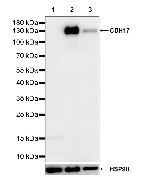 CDH17 Recombinant Rabbit mAb (SDT-3276-83)
