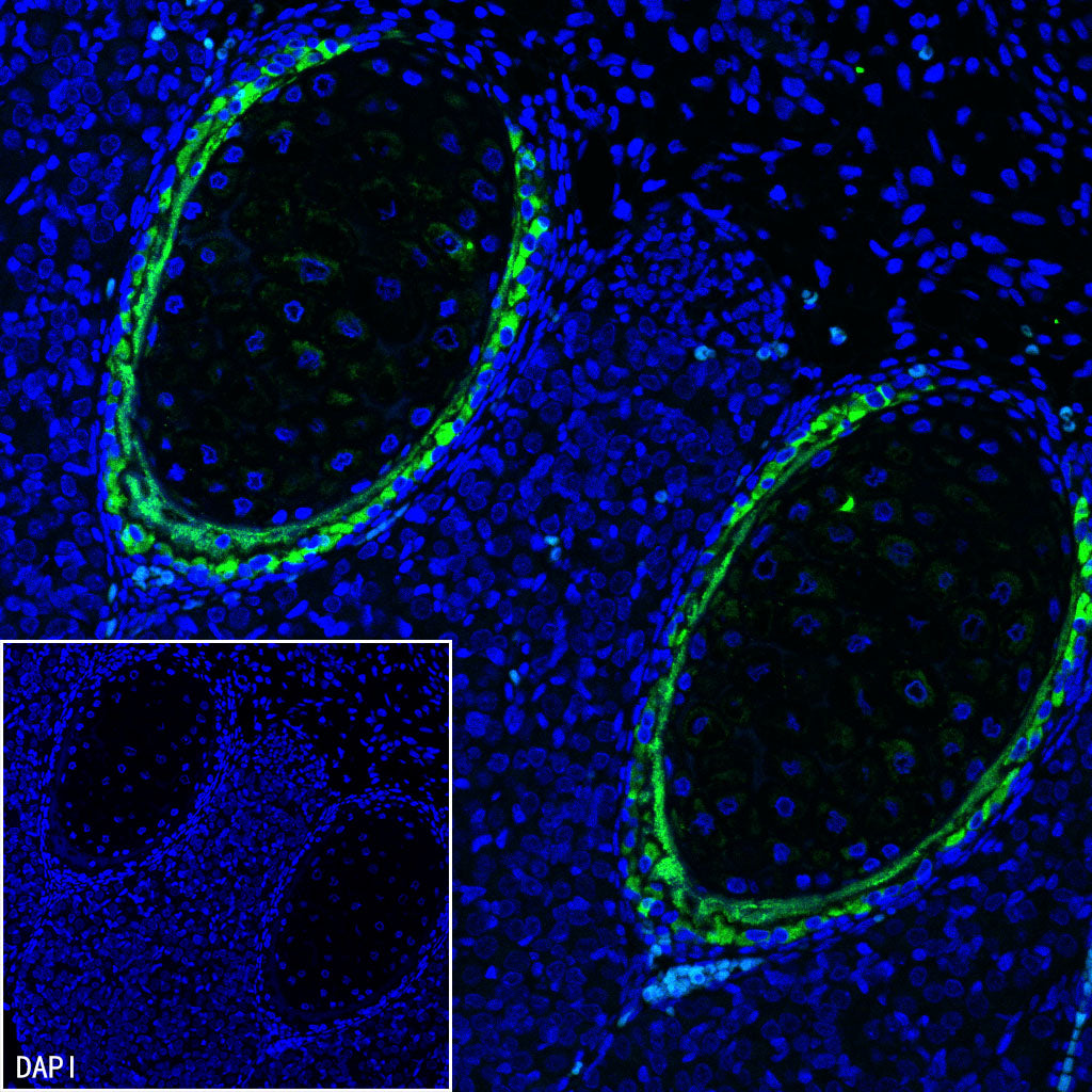 BSP II Recombinant Rabbit mAb (SDT-3508-1)