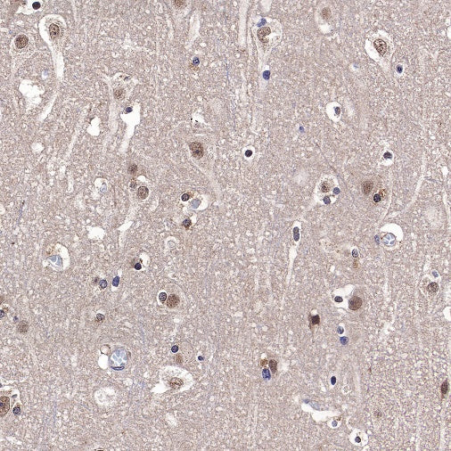ADK Rabbit Polyclonal Antibody