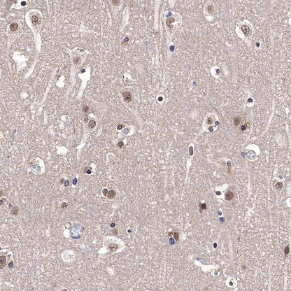 ADK Rabbit Polyclonal Antibody