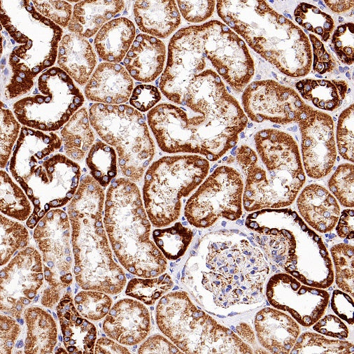 CPT1A Recombinant Rabbit mAb (S-1263-2)