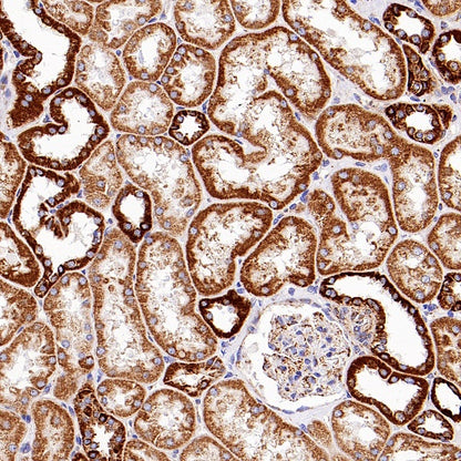 CPT1A Recombinant Rabbit mAb (S-1263-2)