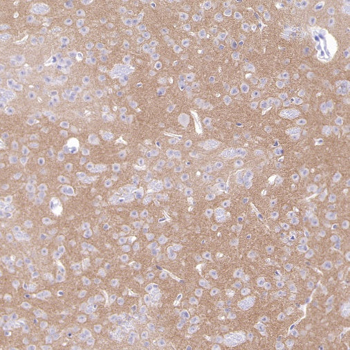 KCND2 Recombinant Rabbit mAb (S-3102-32)